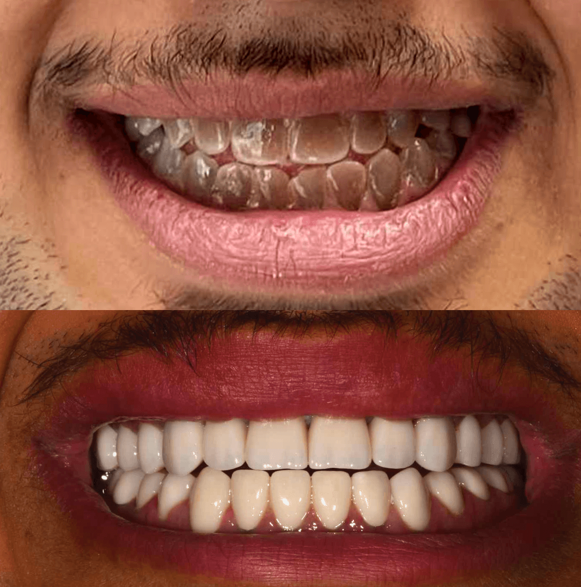 Cosmetic Reconstruction