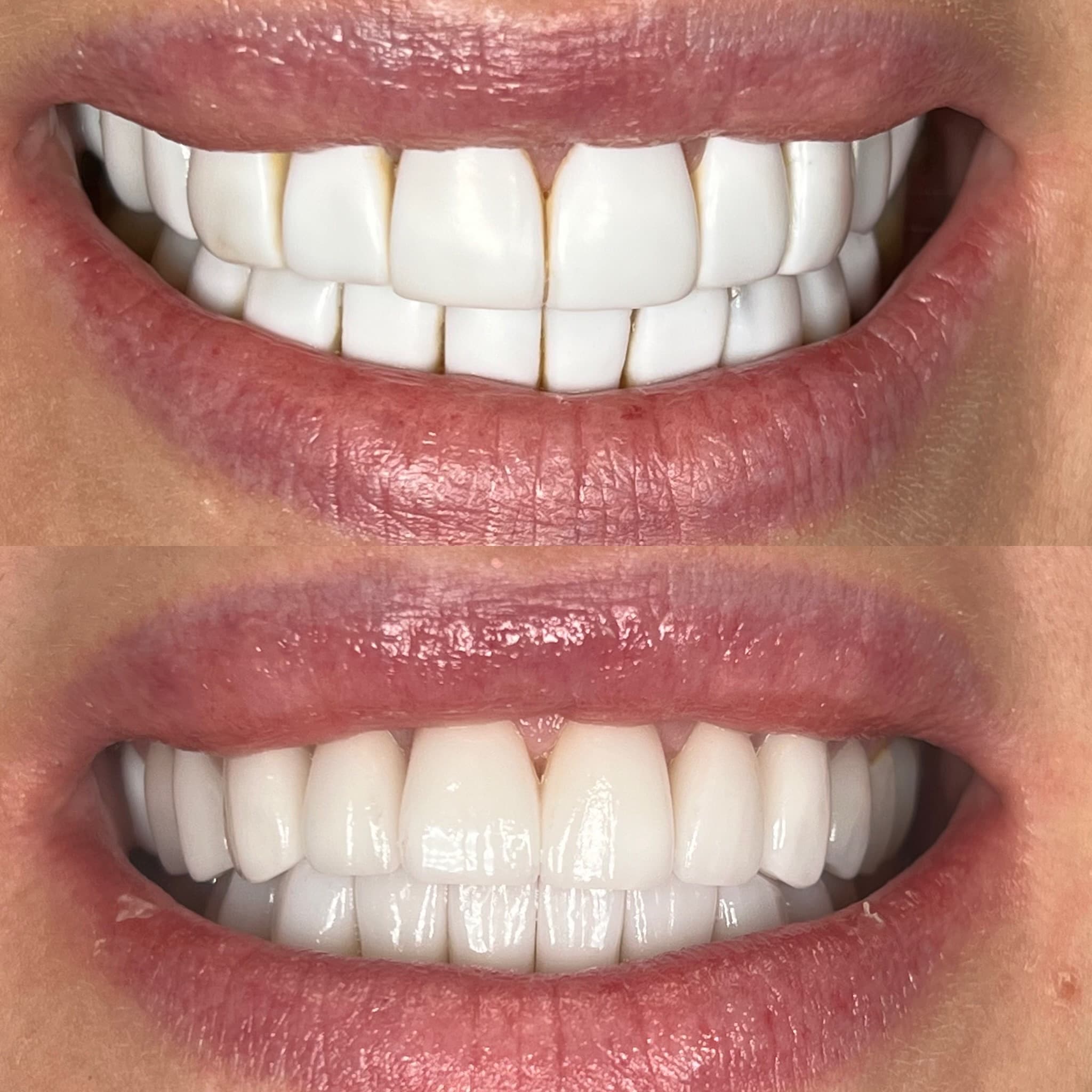 Functional & Aesthetic Restoration